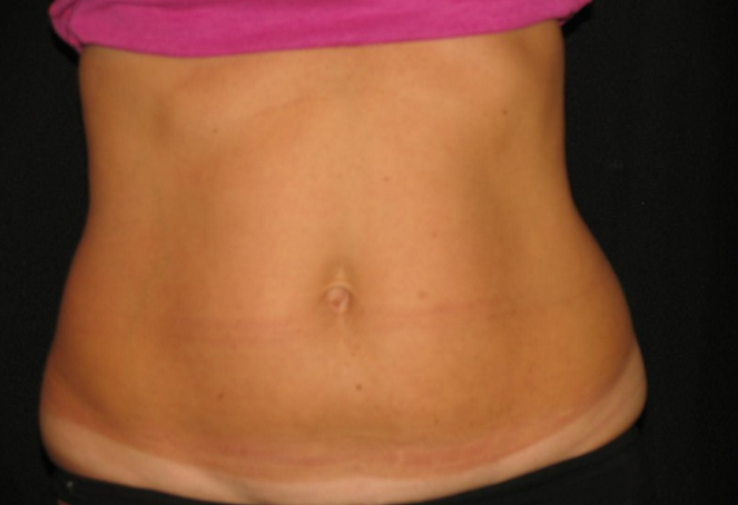 slimmer body